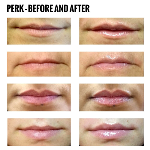 hydro-before-after A grid of eight close-up images shows lips before (left) and after (right) a treatment, with the after images appearing glossier and smoother than the before images. Text at top reads PERK - BEFORE AND AFTER.